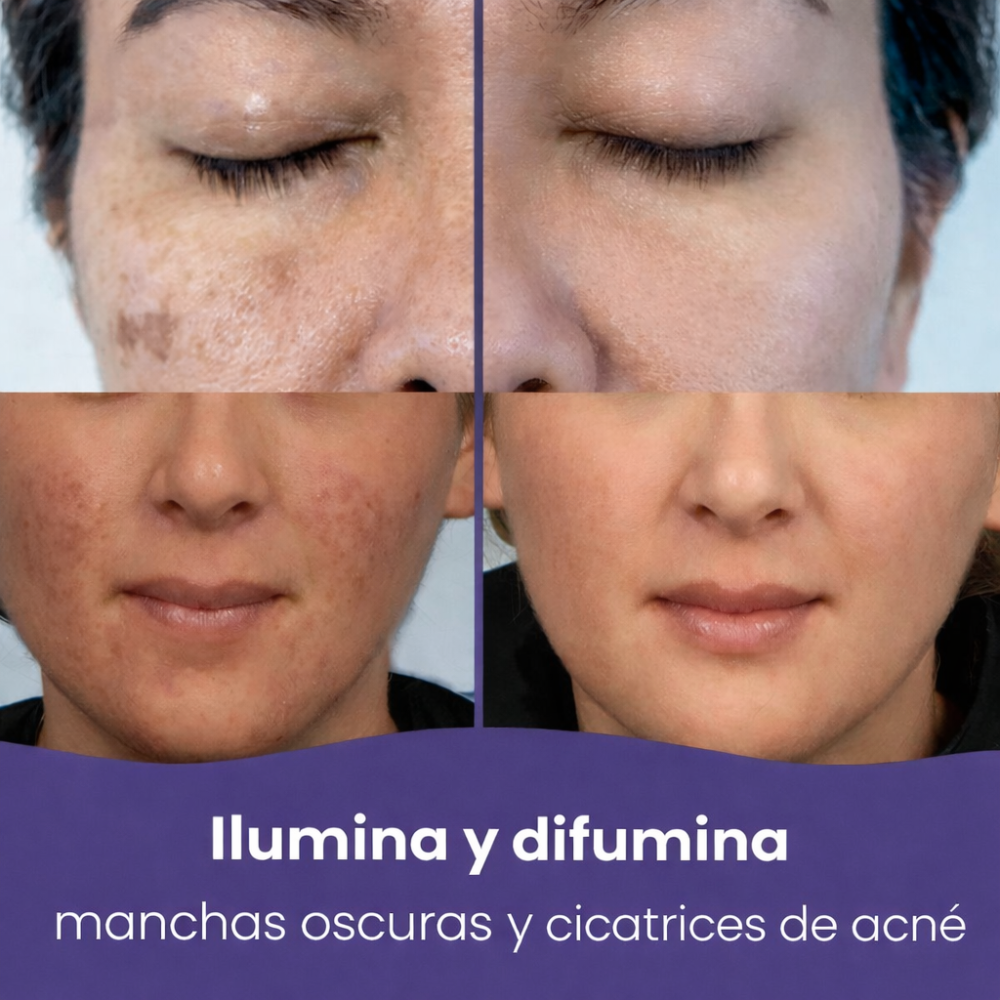 Limpiadores de ácido kójico y cúrcuma