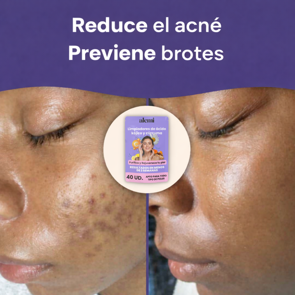 Limpiadores de ácido kójico y cúrcuma